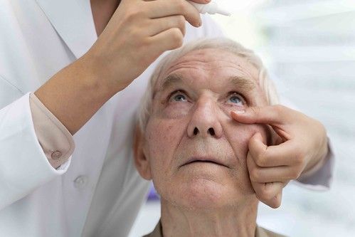 Degeneración Macular Asociada a la Edad, ¿es grave?